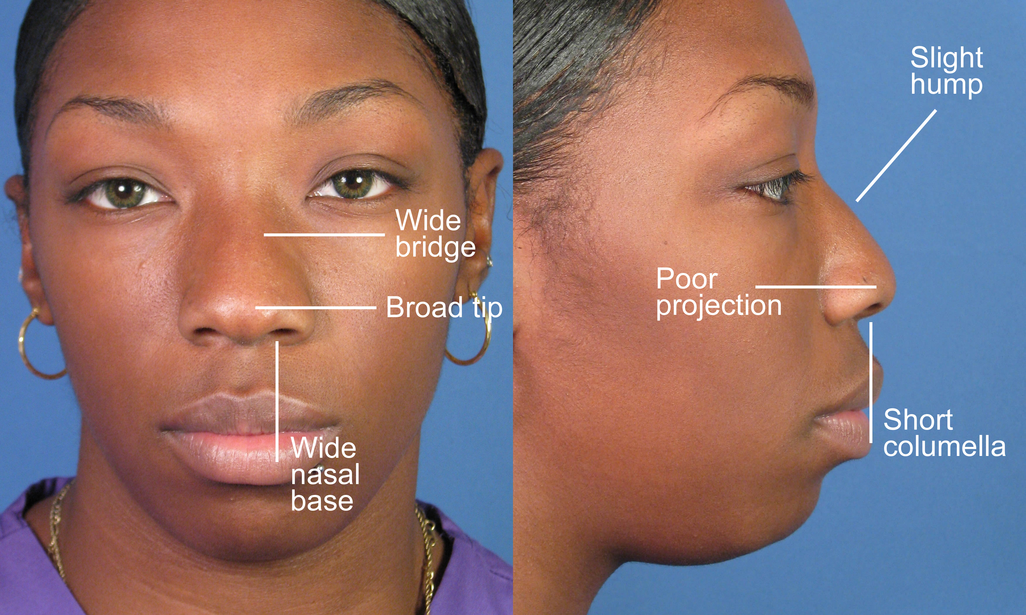 African American Facial Features 68