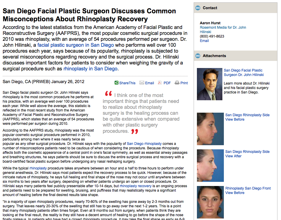 plastic, surgeon, surgery, rhinoplasty, recovery, san, diego, ca