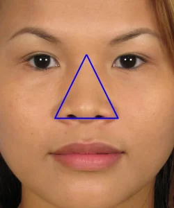 Close-up of an Asian woman's face with a blue triangle drawn over the nose area, emphasizing the nose shape.