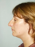 Profile view of a person with closed eyes, showing side of face, nose, and hair.
