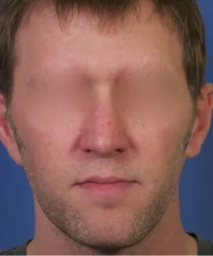 A person with blurred facial features against a blue background.
