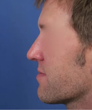Side profile of a man with short brown hair and a beard against a blue background.