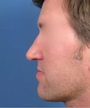 Profile view of a man with short brown hair and facial stubble against a blue background.