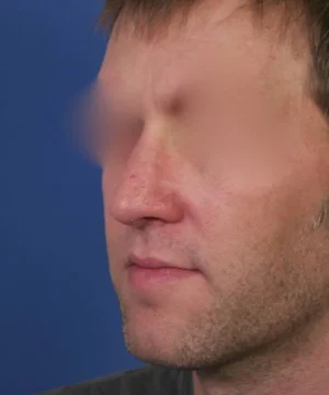 A close-up of a man's face in profile against a blue background. The man's eyes are blurred out.