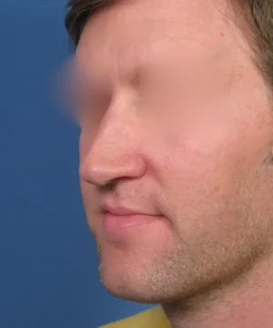 A man with blurred facial features, short hair, and wearing a yellow shirt is pictured in front of a blue background.