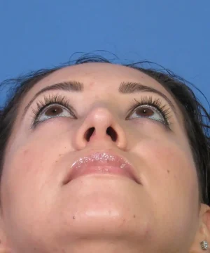 Close-up of a person's face from below, showing the nose, lips, and eyes looking upwards against a blue background.