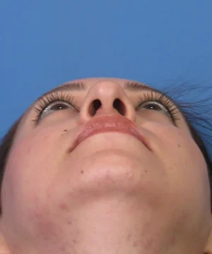 Person with a slightly upward gaze, viewed from below, showing nose and chin against a blue background.