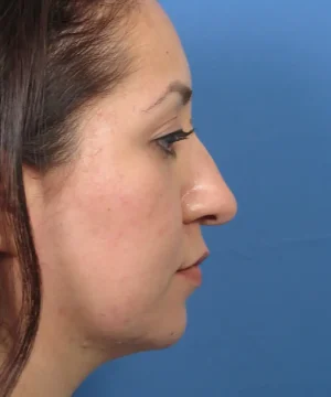 Profile view of a woman with dark hair against a blue background.