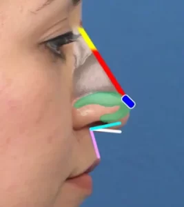Side profile of a human face with colored lines and shapes illustrating facial structure over the nose and lips against a blue background.