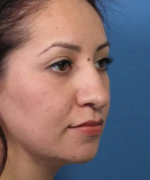A person with long hair and neutral expression is shown in profile view against a blue background.