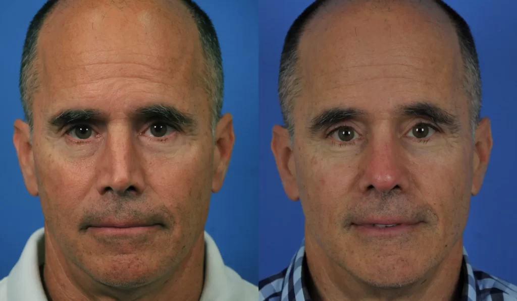 Two side-by-side portraits of the same middle-aged man with a receding hairline, one wearing a white shirt and the other in a checkered shirt, against a blue background.