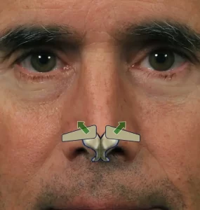 Close-up of a man's face showing an illustration of arrows pointing towards the nasal passages.
