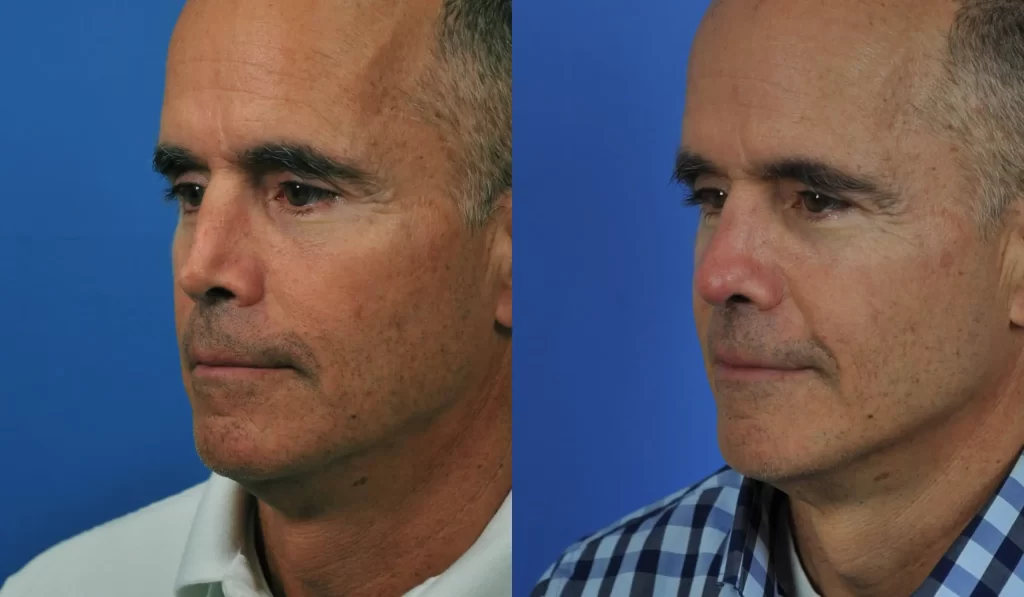 Two side-by-side portraits of a man with short hair against a blue background, wearing a white shirt on the left and a checkered shirt on the right.