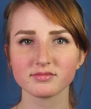 A person with freckles and reddish-brown hair, wearing a neutral expression against a blue background.