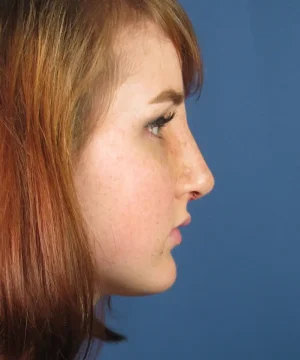 Profile view of a person with light brown hair against a blue background.