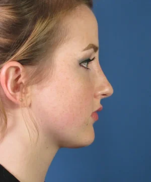 Profile view of a person with tied back hair against a blue background.