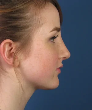 Profile view of a woman with red hair against a blue background, showing facial features in profile.