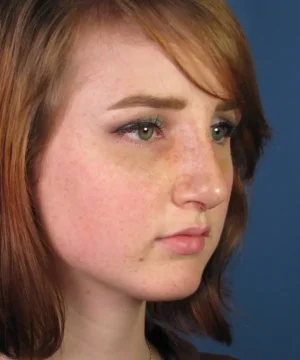A young person with short auburn hair and freckles gazes to the right against a blue background.