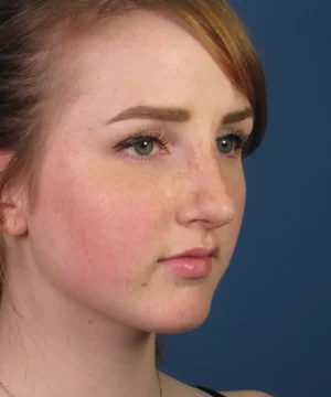 Person with light skin and red hair looking to the right against a blue background.