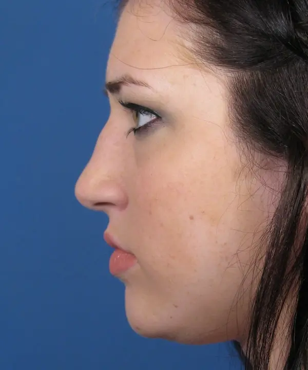 Profile view of a person with dark hair against a blue background.