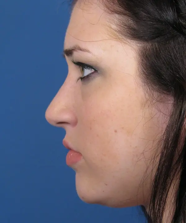 Profile view of a person with long dark hair against a blue background.