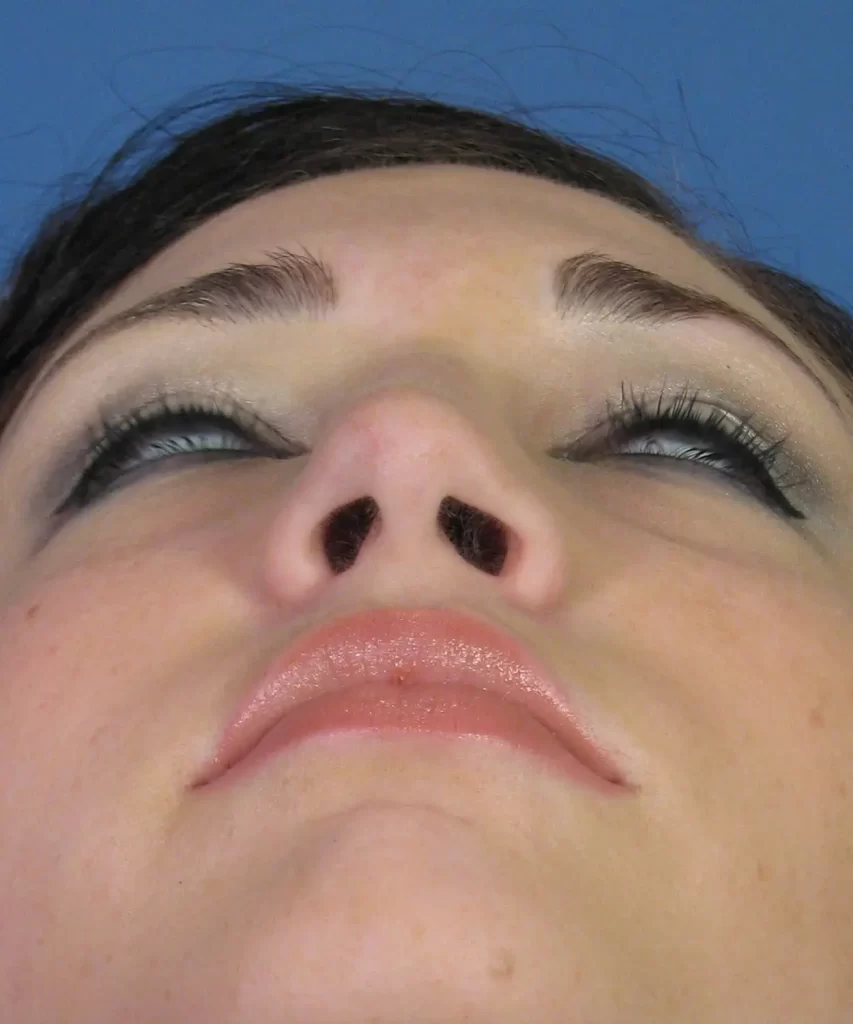 Close-up of a person's face from below, showcasing the nose and lips against a blue background.