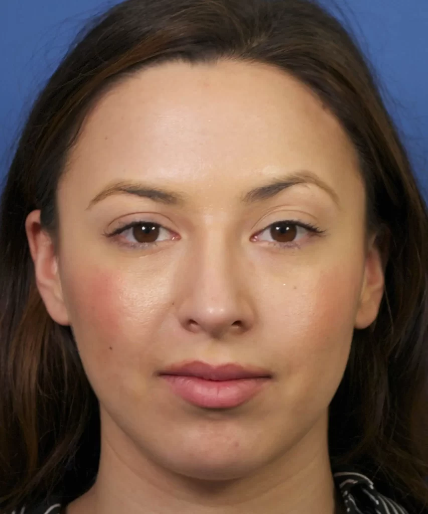 A woman with long brown hair and wearing a striped shirt is facing the camera against a blue background.