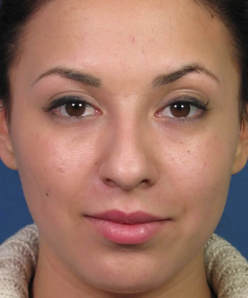 A woman with dark hair is looking directly at the camera, wearing a light-colored top, against a blue background.