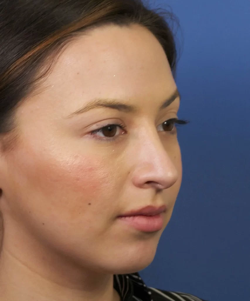 Profile view of a person with light skin and brown hair against a blue background.