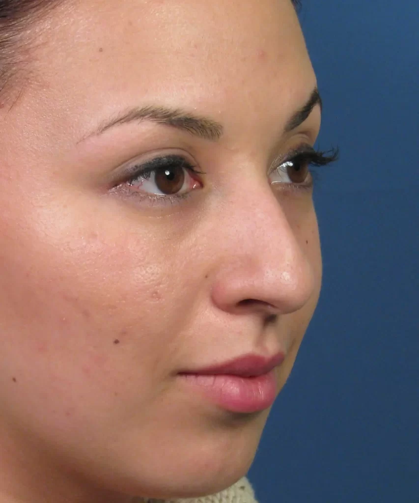 A woman with clear skin and light makeup is shown in profile against a blue background.