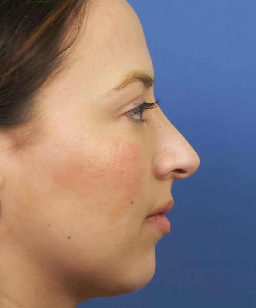 Profile view of a woman's face against a blue background.