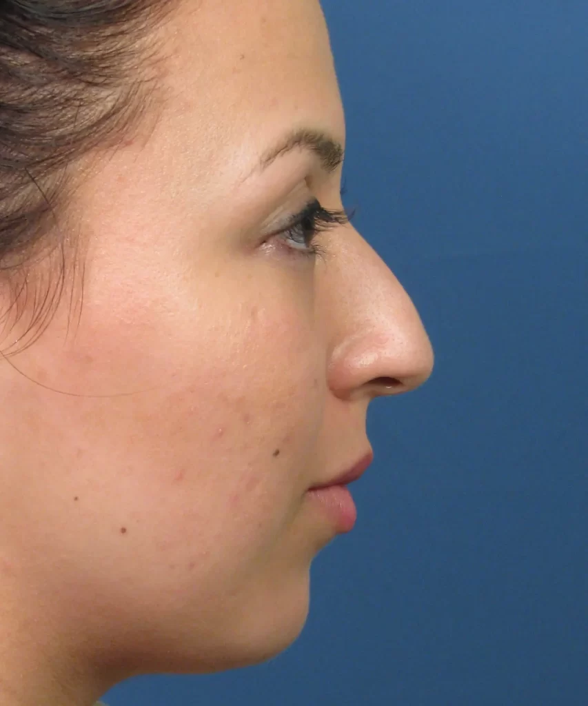 Profile view of a person with dark hair against a blue background.