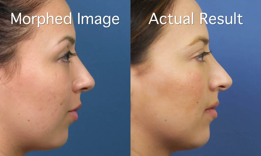 Side-by-side comparison of two female profiles against a blue background, labeled "Morphed Image" and "Actual Result," showing subtle differences in nose shape.