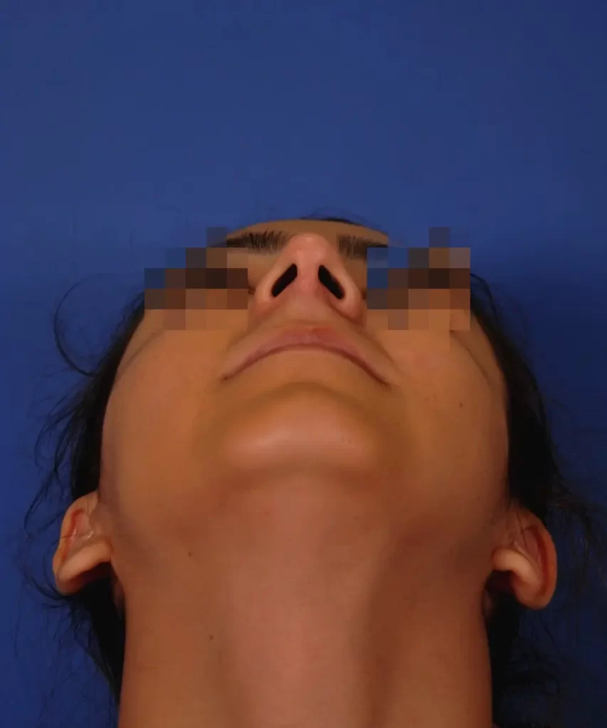 Person looking upward with blurred eyes against a blue background.