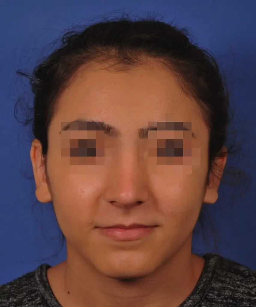 A person with blurred eyes against a blue background.