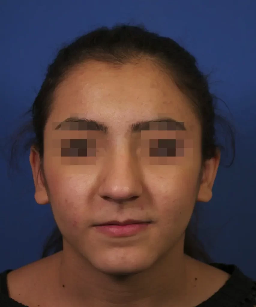 The image shows a person with long dark hair against a blue background. The eyes are pixelated for privacy.