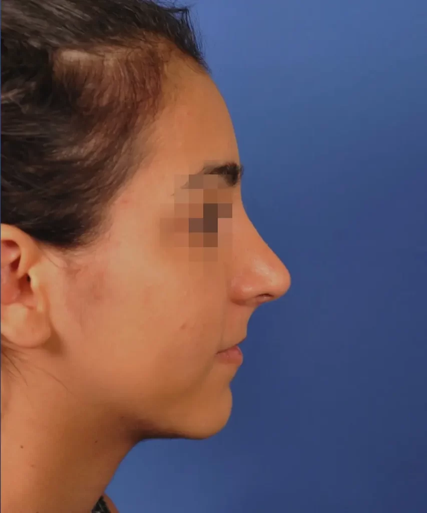 Profile view of a person against a blue background, with the facial features slightly pixelated for privacy.