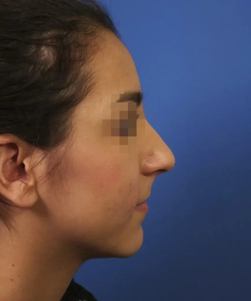 Side profile of a person with a blurred face against a blue background.