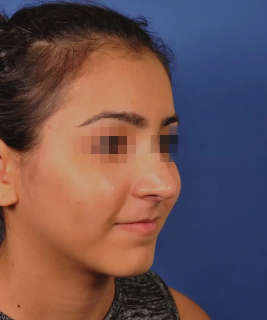 Profile view of a person with pixelated eyes against a blue background.