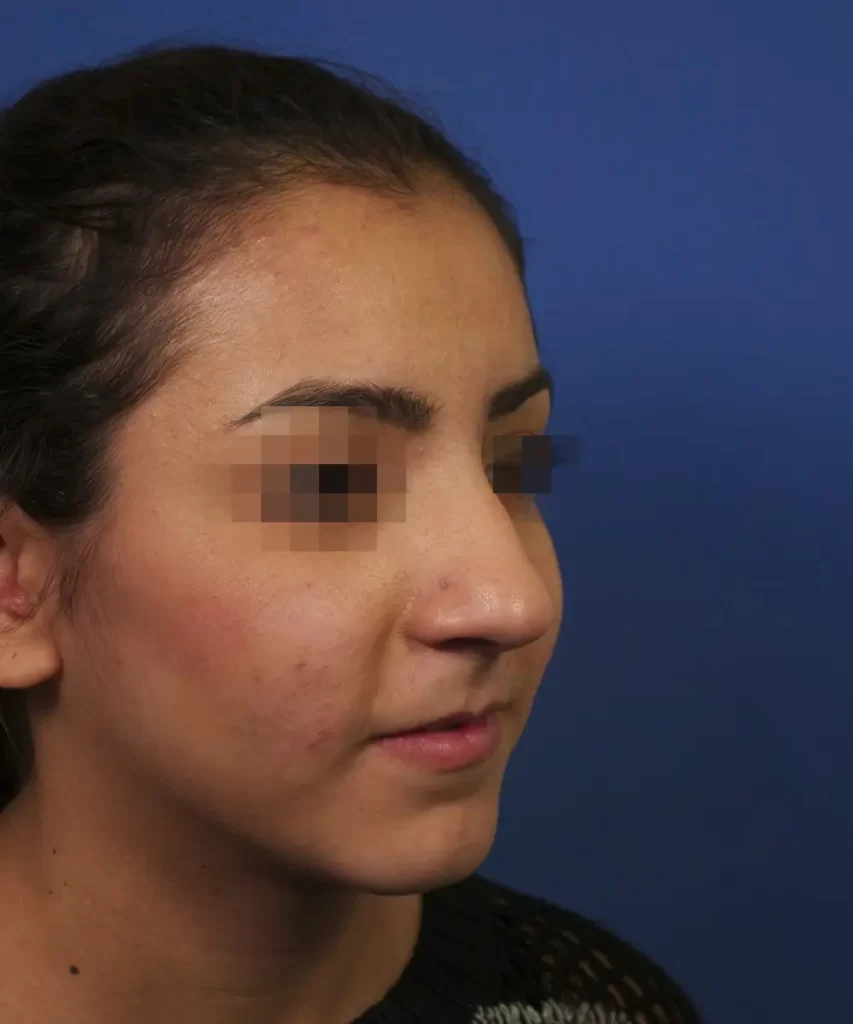 Profile view of a woman with pixelated eyes, against a blue background.