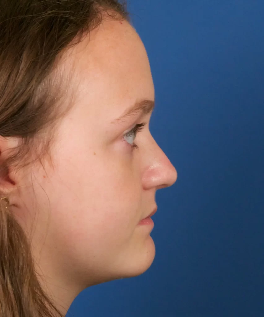 Profile view of a person with long hair against a blue background.