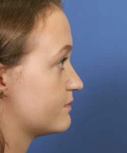 Profile view of a person with long hair against a blue background.