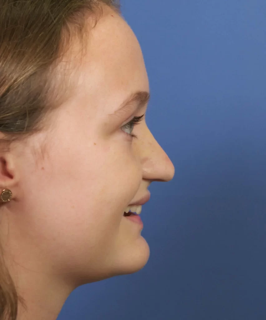Side profile of a person with brown hair against a blue background.