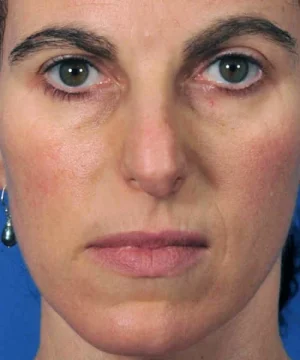 Close-up of a person with a neutral expression, wearing a pearl earring, against a blue background.