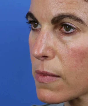 Close-up of a person's face with focus on green eyes, brown eyebrows, and slightly flushed skin against a blue background.