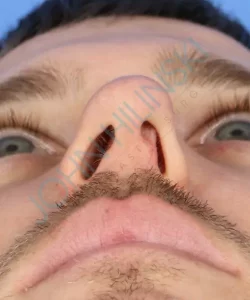 Close-up of a person's face viewed from below, focusing on the nostrils and facial hair.