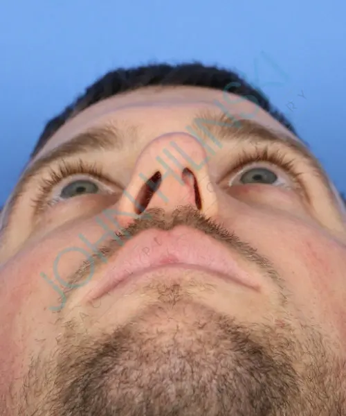 Close-up view of a man's face from below, highlighting his nose and eyes against a blue background.