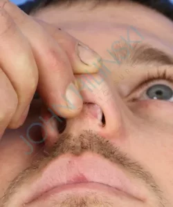 Close-up of a person lifting their nose, showing the nostril and facial hair.