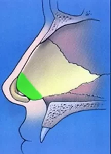 Illustration of a cross-section of a human nasal cavity highlighting a green triangular area in the front part of the nose.