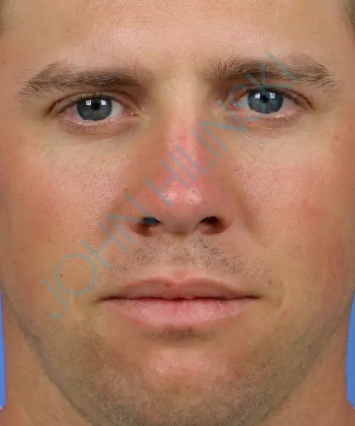 Close-up of a man's face with short hair, neutral expression, and a blue background. A semi-transparent watermark is across the image.
